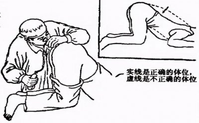 考上公务员后必过的一关——"爆菊花"